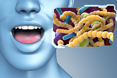 An illustration depicting a human mouth with an open tongue and a microscopic image of bacteria with a blue background, suggesting a theme related to oral health or germs.