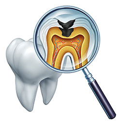 An illustration of a magnified dental implant with an X-ray view showing the internal structure and a small fish design on top.