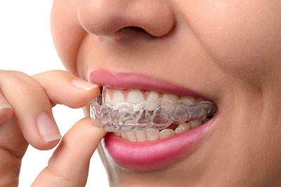 The image shows a person with braces, holding their finger to their mouth.
