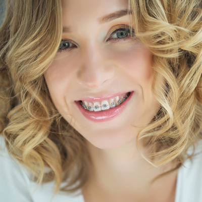 A woman with braces and a slight smile, wearing makeup and a white top.