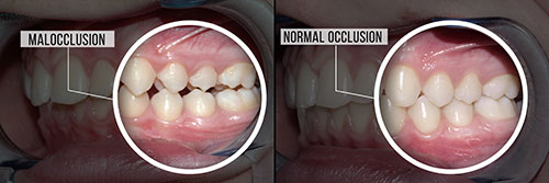 The image shows a side-by-side comparison of two dental implant procedures, with the left side depicting an incomplete or failed implant and the right side showing a successful, fully integrated implant.
