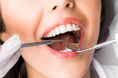 A woman with a wide smile is seated in front of a dental professional, who appears to be performing a procedure on her teeth.